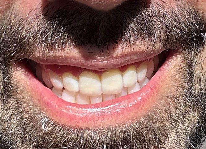 In natural sunlight, you can really see the layering, texture, subtle spots, and marks that mimic real enamel. It was hand sculpted with care, not glossy or fake like porcelain ceramic often looks.