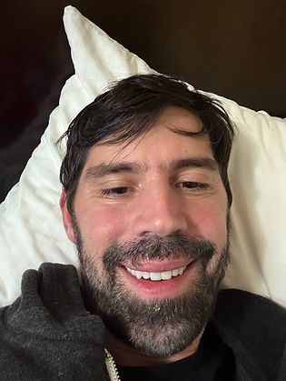 Porcelain veneers Dr. Jordan Davis after day 2