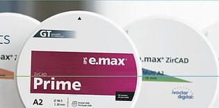 Emax veneers
