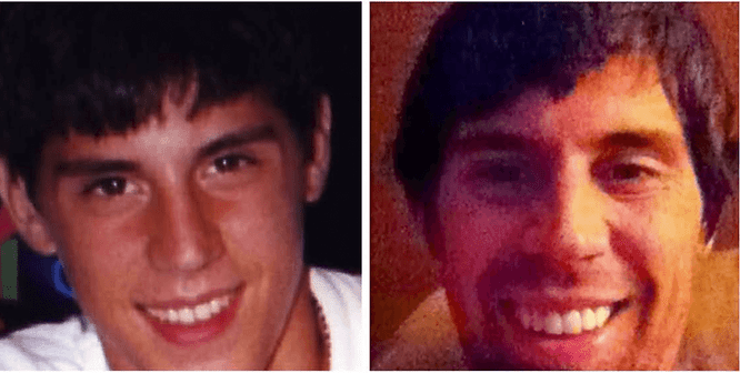 before and after porcelain veneers