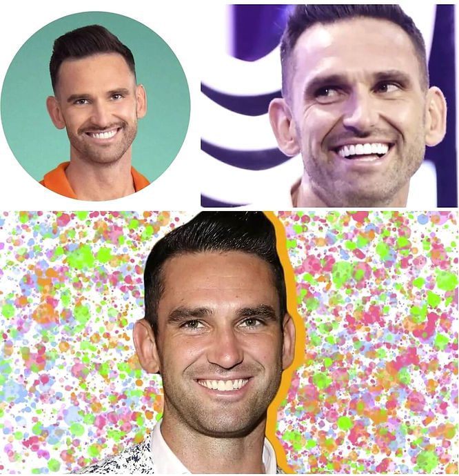 Carl Radke before and aftr veneers