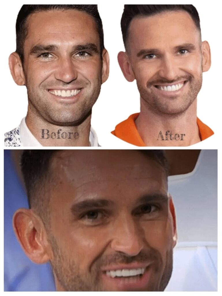 carl radke teeth