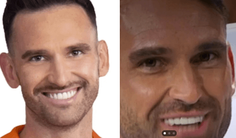 carl radke teeth
