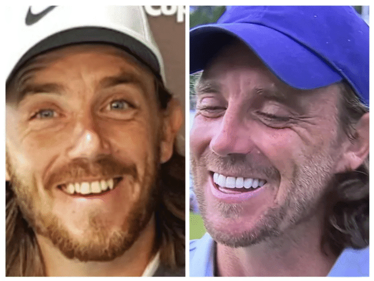 What Happened to Tommy Fleetwood’s Teeth? Porcelain Veneers and the Smile That Erased His Character