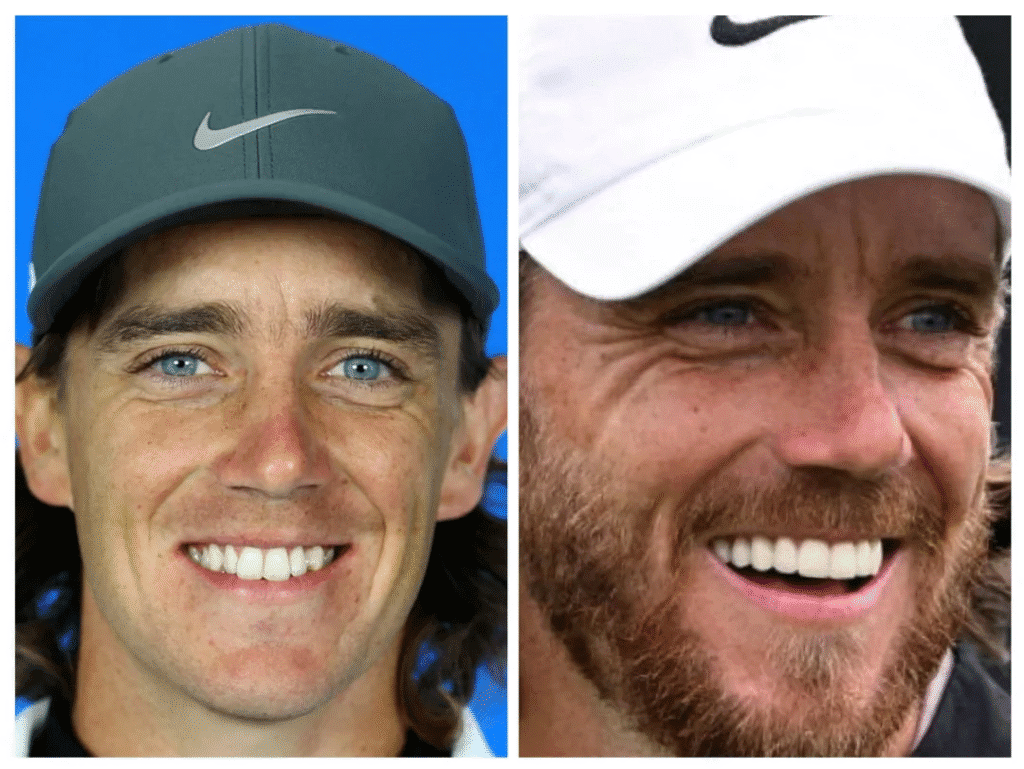 What Happened to Tommy Fleetwood’s Teeth? Porcelain Veneers and the Smile That Erased His Character 3 Tommy Fleetwood teeth before and after porcelain veneers side by side comparison showing natural smile on left and altered smile on right