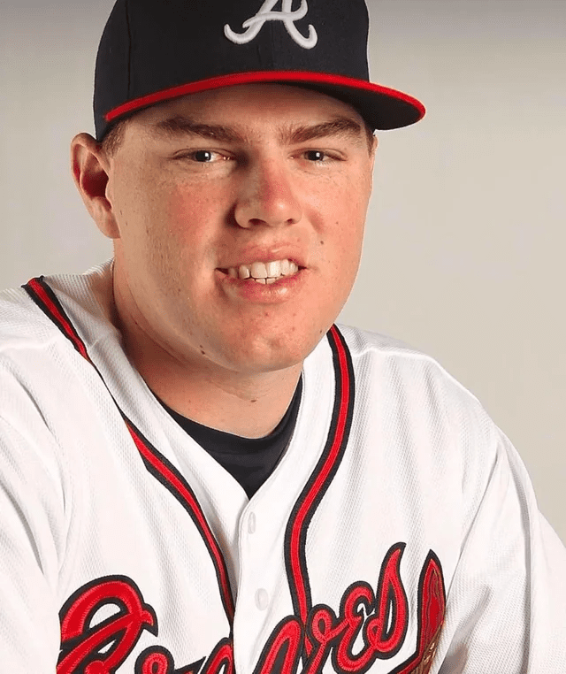 Freddie Freeman Veneers Before and After: Did Cosmetic Dentistry Go Too Far? 4 Freddie Freeman smiling with natural teeth before veneers, showing a more proportionate and natural look