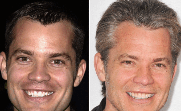 Timothy Olyphant’s Teeth Had Soul and Then Veneers Took It Away