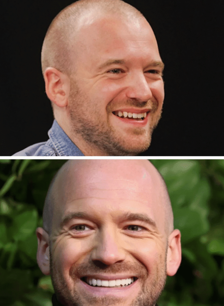 Sean Evans Veneers Are a Warning About Perfect Smile 2 Side-by-side comparison of Sean Evans smiling—top image shows his natural, slightly uneven teeth with warmth and texture; bottom image shows his post-veneer smile with ultra-white, uniform porcelain teeth.