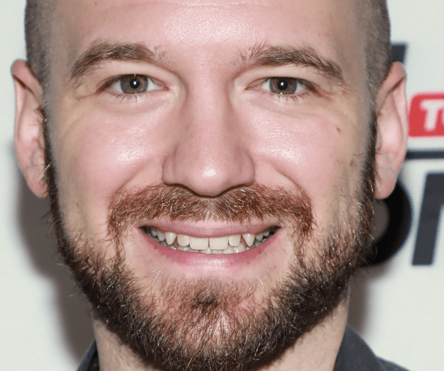 Sean Evans Veneers Are a Warning About Perfect Smile 3 Close-up of Sean Evans smiling before veneers, with natural teeth visible and a full beard, highlighting the individuality and character in his original smile.