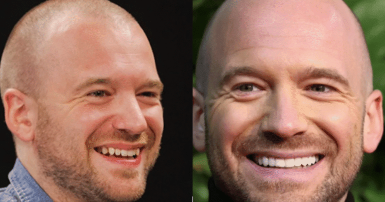Sean Evans Veneers Are a Warning About Perfect Smile 17 sean evans veneers