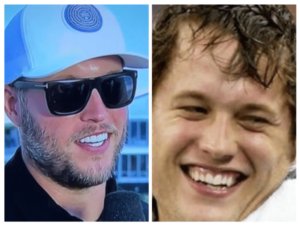Matthew Stafford Veneers Before and After: Who’s Really to Blame? 3 Side-by-side comparison of Matthew Stafford smiling, showing differences between his natural teeth and porcelain veneers.