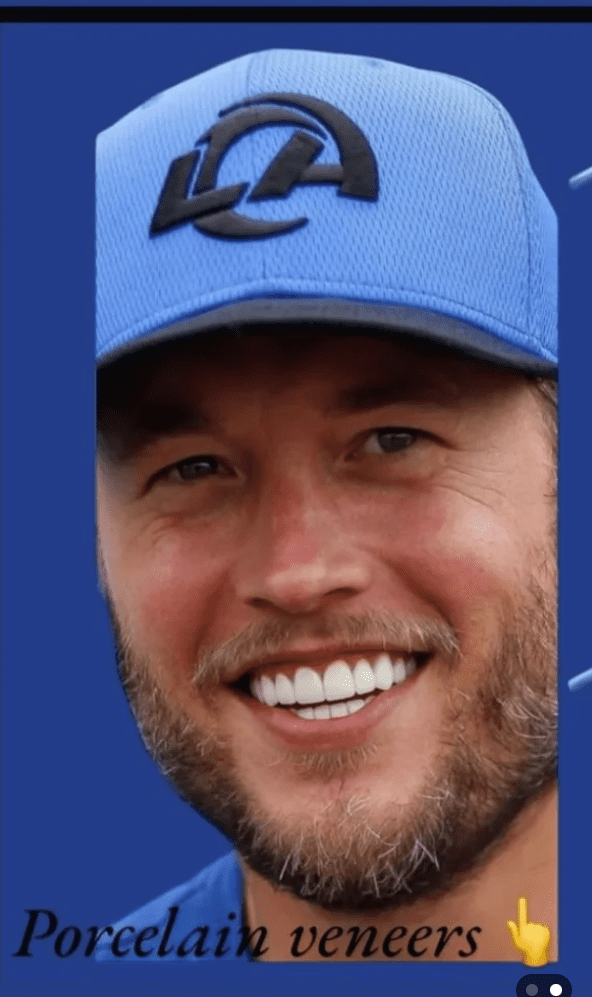 Matthew Stafford Veneers Before and After: Who’s Really to Blame? 4 Matthew Stafford wearing a blue Rams cap, showing a close-up of his porcelain veneers.