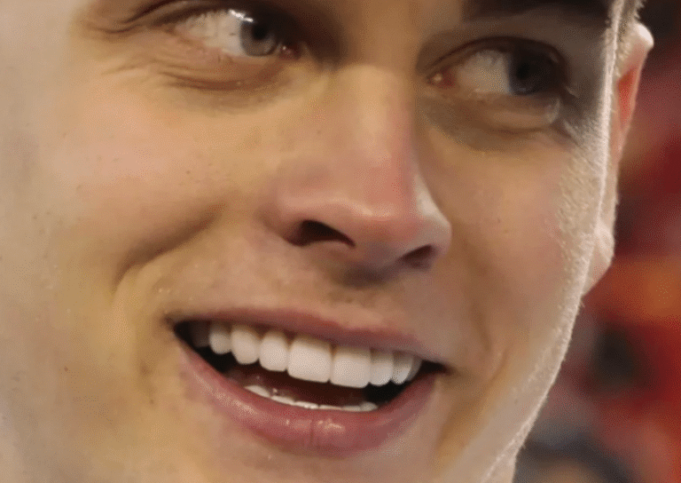 Joe Burrow Teeth and Veneers: When Perfection Replaces Personality