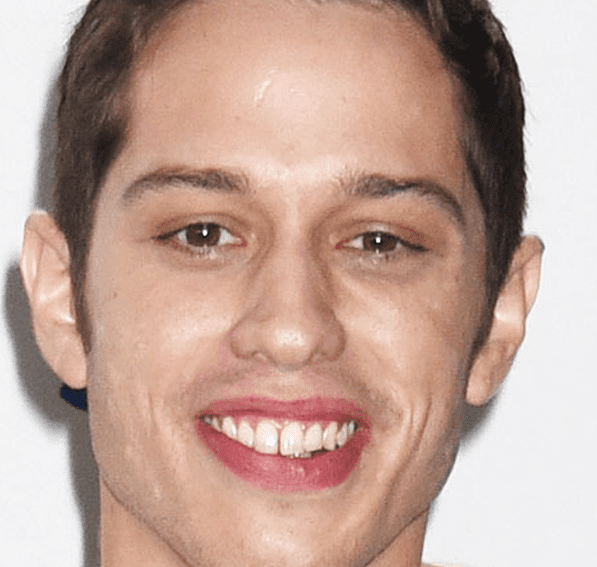 Close-up of Pete Davidson’s natural smile before veneers, featuring slightly uneven teeth and a visible gap that added uniqueness to his look